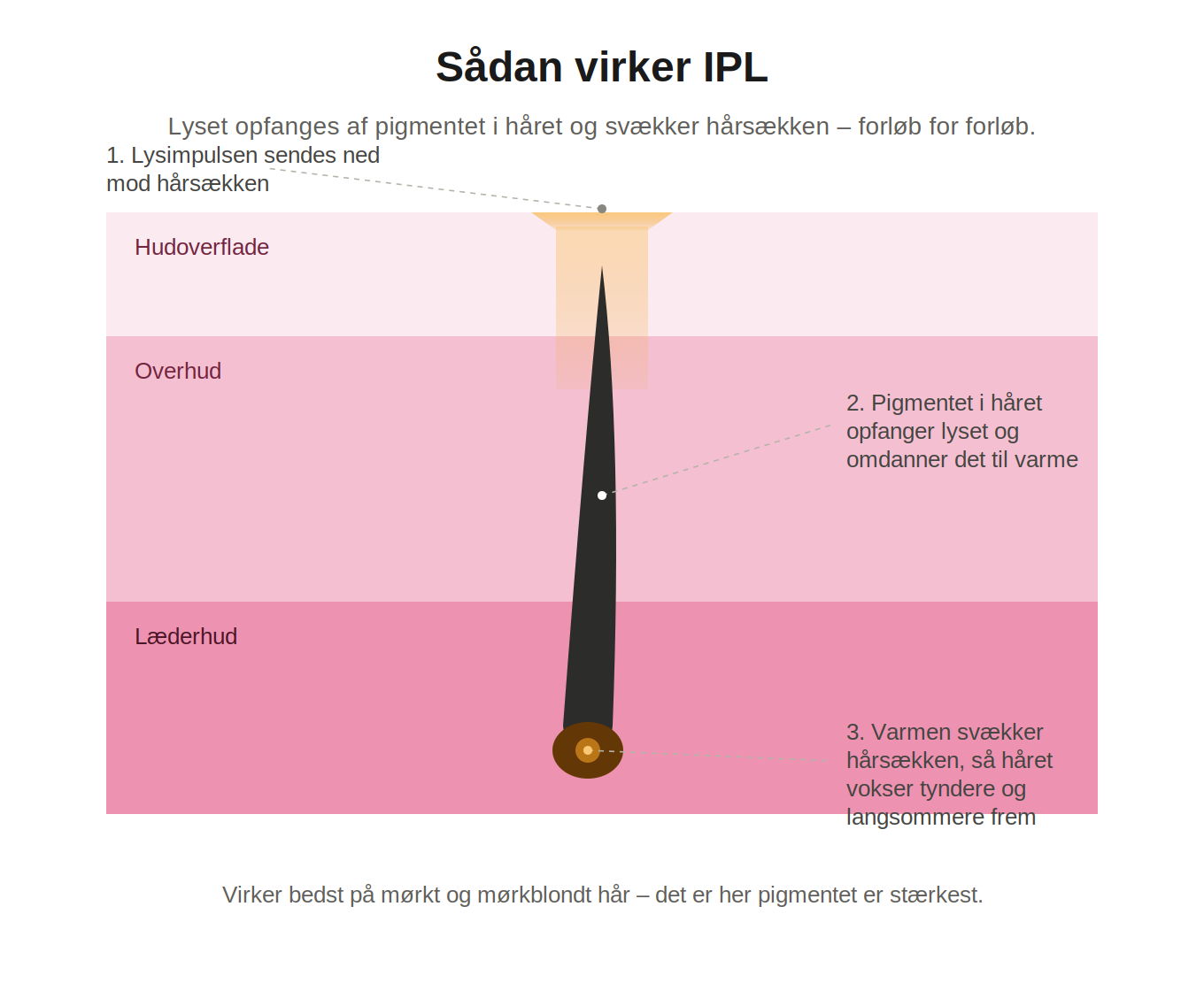 Aveline Lumi – IPL Hair Remover for Body and Face